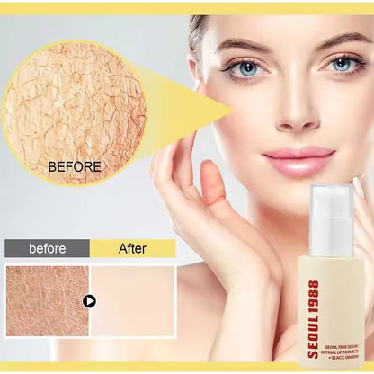 K-SECRET Seoul 1988 Eye Cream Retinal Liposome 4% + Fermented Bean 30 Ml